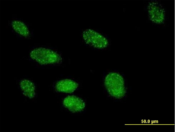 Immunofluorescence analysis of paraformaldehyde-fixed HeLa cells, labeling FKBP25 using purified ab168772 at 10 µg/ml. Antibody purification with Protein A will be needed prior to use.