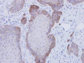 Immunohistochemical analysis of paraffin-embedded Cal27 xenograft, using ab97306 at 1/500 dilution.