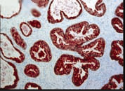 ab59460 at 1/100 dilution staining FKBP52 in prostate tissue section by Immunohistochemistry (Bouin's fixative fixed paraffin-embedded tissue section). Antigen retrieval was done by microwave in citrate buffer. A HRP conjugated goat anti mouse secondary was used at 1/10 dilution.