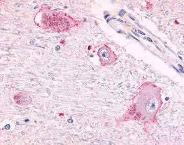 Ab12958 positively staining formalin fixed, paraffin embedded neuronal brain tissue.
