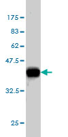 Western blot against tagged recombinant protein immunogen using ab54965 Flamingo homolog 1 antibody at 1ug/ml.