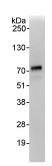Detection of Human FLCN by Immunoprecipitation in whole cell lysate from HeLa cells (1 mg for IP, 20% of IP loaded), using ab87753 at 3 µg/mg lysate for IP and 1 µg/ml for subsequent WB. Detection: chemiluminescence with an exposure time of 10 seconds.