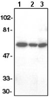 All lanes : Anti-FLIP antibody (ab6144) at 1/1000 dilutionLane 1 : HeLa whole cell lysateLane 2 : Jurkat whole cell lysateLane 3 : K562 whole cell lysate