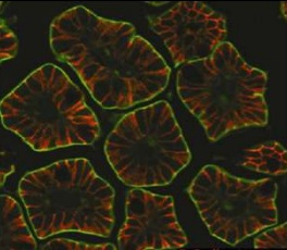 Immunofluorescence analysis of Mouse intestine labeling CRB3 with ab1808350 at a 1/100 dilution. E-cadherin staining was used to highlight the lateral membrane in mouse intestine.