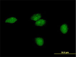 ab69400 at 10µg/ml staining FLJ35220 in Hela cells by ICC/IF.