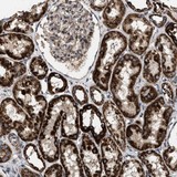 ab121688 at 1/75 dilution staining FLJ36733 in Paraffin-embedded Human kidney tissue by Immunohistochemistry.