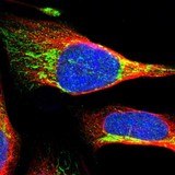 ab121688 at 4 µg/ml staining FLJ36733 in PFA/Triton X-100 fixed/permeabilized U 2 OS cells by Immunofluorescence (green).