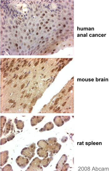 ab41927 (1/100) staining Flotilin 1 in paraffin embedded - Human (anal cancer), Mouse (brain) and Rat (spleen) tissues. Tissue sections underwent paraformaldehyde fixation, heat mediated antigen retrieval using Citrate Buffer pH 6.0 and were blocked using sequential peroxidase and protein block (prediluted). Please refer to abreview for further experimental details.See Abreview