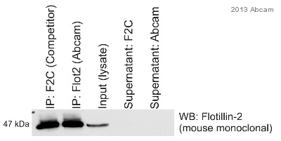 Flotillin 2 immunoprecipitation from Human HeLa whole cell lysate using ab96507. 750 µg of cell lysate was incubated with primary antibody (1/500) and matrix (Protein A) and incubated for 16 hours at 4°C.Lane 1 : anti-Flotillin 2 IP (using non-Abcam antibody)Lane 2 : anti-Flotillin 2 IP (using ab96507)Lane 3 : Input (HeLa cell lysate)Lane 4 : Supernatant IP (using non-Abcam antibody)Lane 5 : Supernatant IP (using ab96507) Western blot detection : mouse anti-Flotillin 2 antibody + HRP donkey anti-mouse polyclonal secondary antibodySee Abreview