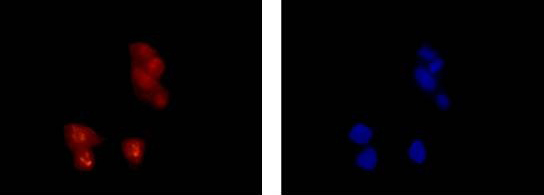 Immunocytochemsitry/Immunofluorescence analysis of LnCap cells labelling CRCP (red) with purified ab139264 at 1/250. Cells were fixed with 4% paraformaldehyde. An Alexa Fluor® 555-conjugated goat anti-rabbit IgG (1/200) was used as the secondary antibody. Counterstained with DAPI (blue).