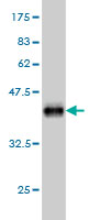 Western blot against tagged recombinant protein immunogen using ab57317 FLVCR antibody at 1ug/ml.