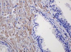 Immunohistochemical analysis of paraffin embedded Human prostate tissue labelling FNDC4 with ab140381 at a 1/150 dilution.