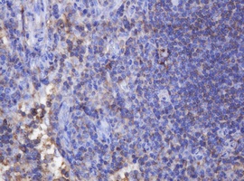 Immunohistochemical analysis of paraffin embedded Human lymph node tissue labelling FNDC4 with ab140381 at a 1/150 dilution.