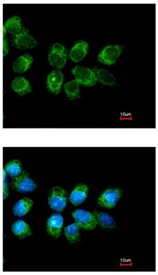 Immunofluorescent analysis of methanol-fixed A431 cells labelling Folate Binding Protein with ab137347 at 1/200 dilution. Lower panel is costained with Hoechst 33342.