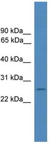 Anti-Folate Receptor 4 antibody (ab108067) at 1 µg/ml + MCF7 cell lysate at 10 µg