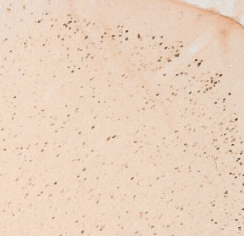 ab11959 Fos B antibody (1/1000) immunostaining for Fos B in rat brain cortex. Staining was also detected in the striatum as expected (not shown). Rats were treated with high dose amphetamine (5mg/kg) 30 min prior to transcardial perfusion to induce Fos B expression. The staining procedure was perfomed according to the TH staining in Carlsson et al. (2005) Brain 128:559-569 with the exception that the quenching step was excluded from the staining.