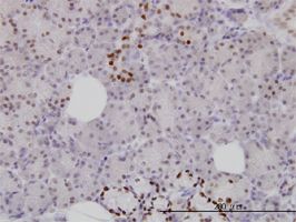 FOXA1 antibody (ab55178) used in immunohistochemistry at 3ug/ml on formalin fixed and paraffin embedded human salivary gland.