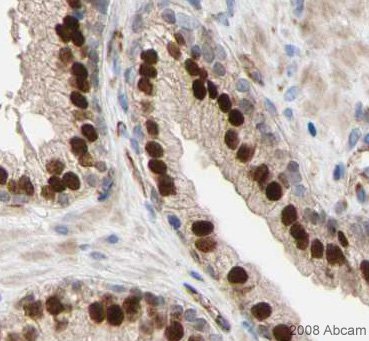 (Image courtesy of Human Protein Atlas) ab23738 staining FOXA1 in Human prostate. Paraffin embedded human prostate tissue was incubated with ab23738 (1/200 dilution) for 30 mins at room temperature. Antigen retrieval was performed by heat induction in citrate buffer pH 6. ab23738 was tested in a tissue microarray (TMA) containing a wide range of normal and cancer tissues as well as a cell microarray consisting of a range of commonly used, well characterised human cell lines. Further results for this antibody can be found at www.proteinatlas.org