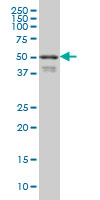 Anti-FOXA2 antibody (ab60721) at 1 µg/ml + HepG2 cell lysate at 25 µg