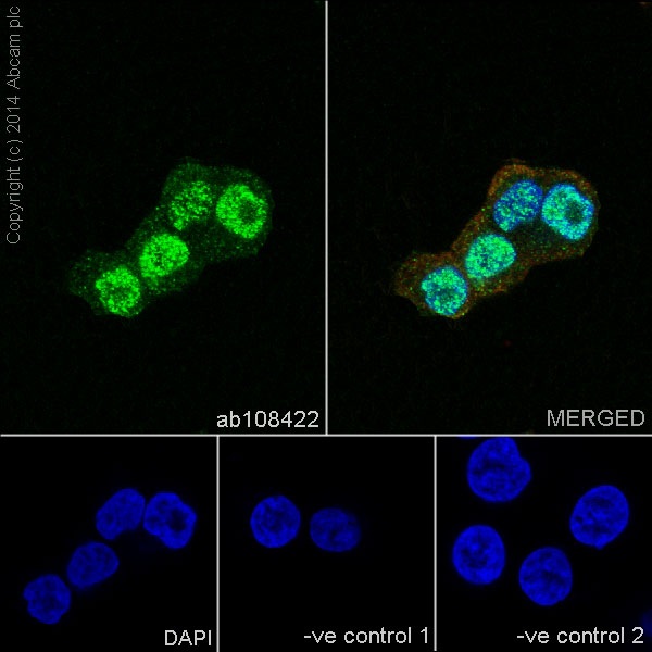 Immunocytochemistry/Immunofluorescence analysis of HT-29 cells labelling FOXA2 with purified ab108422 at 1/300. Cells were fixed with 4% paraformaldehyde and permeabilized with 0.1% Triton X-100. ab150077, an Alexa Fluor® 488-conjugated goat anti-rabbit IgG (1/500) was used as the secondary antibody. DAPI (blue) was used as the nuclear counterstain. ab7291, a mouse anti-tubulin (1/500) and ab150120, an Alexa Fluor® 594-conjugated goat anti-mouse IgG (1/500) were also used.-ve control 1: primary antibody (1/300) and secondary antibody, ab150120, an Alexa Fluor® 594-conjugated goat anti-mouse IgG (1/500).-ve control 2: ab7291 (1/1000) and secondary antibody, ab150077, an Alexa Fluor® 488-conjugated goat anti-rabbit IgG (1/500).