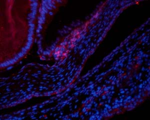 Mouse tissue sections (periocular mesenchyme, cornea) were incubated with ab5079, anti-FOXC1 antibody. Paraformaldehyde was used for fixation, and a heat mediated antigen retrieval step was used. The antibody was incubated for 8 hours at a dilution of 1/200.