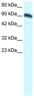 Anti-FOXC2 antibody (ab24340) at 0.6 µg/ml