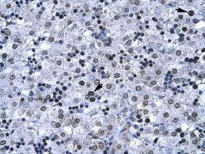 Immunohistochemistry (Formalin/PFA-fixed paraffin-embedded sections) analysis of human liver tissue labelling FOXG1 with ab23470 at a concentration of 4-8µg/ml. Cells with positive label: Hepatocyte (indicated with arrows). Magnification: X400.