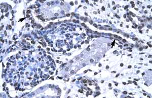 Immunohistochemistry (Formalin/PFA-fixed paraffin-embedded sections) analysis of human kidney tissue labelling FOXG1 with ab23470 at a concentration of 4-8µg/ml. Cells with positive labels (arrows) are Epithelial cells of renal tubule.