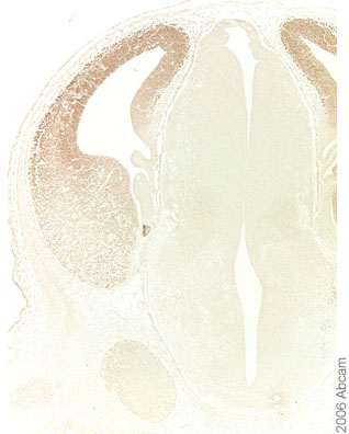 ab18259 staining Foxg1 (1/50) in the telencephalon (but not the diencephalon) as expected. DAB-immunohistochemistry was performed on embryonic (E13.5) mouse brain (coronal paraffin-embedded sections) after microwave treatment with 10mM sodium citrate. 