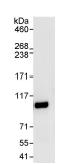 Detection of FOXK1 by Western blot of Immunprecipitate. ab85999, at 1 µg/ml, staining FOXK1 in HeLa whole cell lysate immunoprecipitated using ab85999 at 3 µg/mg lysate (1 mg/IP; 20% of IP loaded/lane). Detection: Chemiluminescence with an exposure time of 3 seconds.