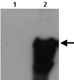 All lanes : Anti-FOXK1 antibody (ab21935) at 1/1000 dilutionLane 1 : Total protein extract from E. coli with ~50ng to 100ng of a negative control fusion protein with an irrelevant antigen at 20 ugLane 2 : Total protein extract from E. coli with ~50ng to 500ng of the antigen fusion protein at 20 ugSecondaryRabbit anti-mouse IgG + IgM, (H+L) horseradish peroxidase conjugated at 1/5000 dilution