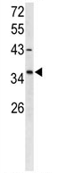 Anti-FOXL1 antibody (ab95286) at 1/100 dilution + CHO cell line lysates at 35 µg