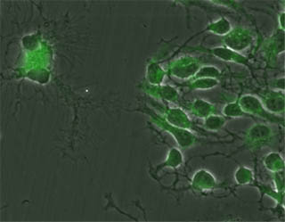 ab12161 staining FOXO1A (1/200) in mouse E11 cortical cells cultured for 6 days. Secondary antibody Alexa 546 goat anti rabbit IgG 1/1000 was incubated for 2 hours at room temperature. Images were taken using a Zeiss camera under 40X objectives.
