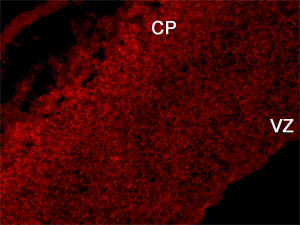 ab12161 staining FOXOA1 (1/200) in the cortical plate (CP) and ventricular zone (VZ=CNS germinal zone) of mouse E13 forebrain tissue. E13 mouse embryos were fixed in 4% paraformaldehyde in PB overnight at 4°C then transferred to 30% sucrose in PBS.  Brains were frozen in TissueTek and stored at -80°C. Cryostat coronal sections were cut at 12µm. Sections were blocked in 0.1% triton in PBS containing 10% normal serum. Primary antibodies were incubated on the sections at 4°C overnight.  Secondary antibody Alexa 546 goat anti rabbit IgG 1/1000 was incubated for 2 hours at room temperature. Images were taken using a Zeiss camera under 40X objectives.