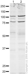 All lanes : Anti-FOXO1A antibody (ab12161) at 1 µg/mlLane 1 : HEK293 (Human embryonic kidney cell line) Whole Cell Lysate (ab7902)Lane 2 : HeLa (Human epithelial carcinoma cell line) Whole Cell Lysate Lysates/proteins at 20 µg per lane.SecondaryRabbit IgG (Alexa Fluor® 680) at 1/10000 dilutionPerformed under reducing conditions.