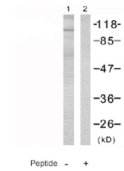All lanes : Anti-FOXO3A antibody (ab47409) at 1/500 dilutionLane 1 : NIH/3T3 cell extractsLane 2 : NIH/3T3 cell extracts with Blocking peptide