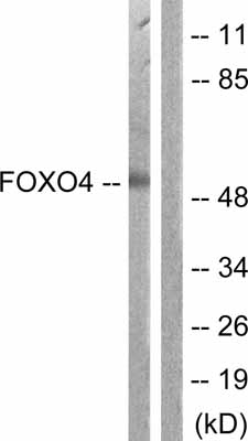 All lanes : Anti-FOXO4 antibody (ab63254) at 1/500 dilutionLane 1 : extracts from K562 cellsLane 2 : extracts from K562 cells, with immunizing peptide