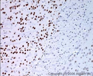 ab16645 was tested in IHC of formalin fixed sections from mouse (over two weeks of age) brain. Antigen retrieval was in citrate buffer and blocking was in 1% BSA. The primary antibody was incubated at a dilution of 1/200 overnight at 4 degrees celsius. The secondary antibody was a biotin conjugated anti-rabbit IgG.