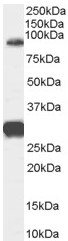 Anti-FOXP2 antibody (ab58599) at 0.3 µg/ml + Human Brain (Cerebellum) lysate (35µg protein in RIPA buffer)