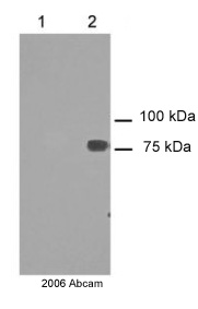 All lanes : Anti-FOXP4 antibody (ab17726) at 1/1000 dilutionLane 1 : 50ug Lung epithelial cell line, non-transfected.Lane 2 : 50ug Lung epithelial cell line, transfected with FOXP4.SecondaryHRP cpnjugated goat anti-rabbitPerformed under reducing conditions.