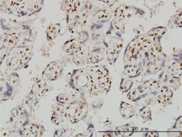 FOXR2 antibody (ab58200) used in immunohistochemistry at 3ug/ml on formalin fixed and paraffin embedded human placenta.