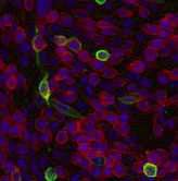 ab26316 staining of FPRL1 in CHO cells using 1µg/106 cells. CHO cells were transiently transfected with an expession vector encoding FPRL1 and binding of ab26316 was visualized using a FITC-conjugated secondary antibody (green). Actin filaments are labelled with Alexa Fluor-55 Phalloidin (red). Cell nuclei are stained with DAPI (blue).