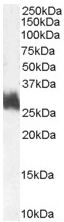 Anti-FRA1 antibody (ab50426) at 1 µg/ml + Human Bone Marrow lysate (35µg protein in RIPA buffer).