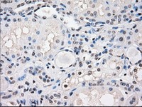 ab117951, at 1/50, staining FRA1 in paraffin-embedded Human Kidney tissue by Immunohistochemistry.