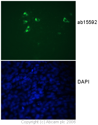 Anti-Fragilis antibody, ab15592, recognised a small proportion of cells in a culture of human embryonic stem cells differentiated into a heterogenous mix of cells. Based upon the sequence of the immunogen used to generate this antibody the protein it recognizes is likely to be IFITM2 and/or IFITM3.