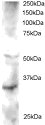 ab2470 staining (2µg/ml) of Human Heart lysate (RIPA buffer, 30µg total protein per lane). Primary incubated for 1 hour. Detected by western blot using chemiluminescence.