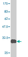 Western blot against tagged recombinant protein immunogen using ab58145 Frizzled 2 antibody at 1ug/ml.