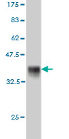 Western blot against tagged recombinant protein immunogen using ab58177 Frizzled 5 antibody at 1ug/ml.