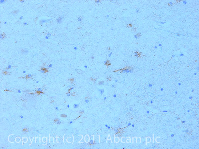 IHC image of ab75235 staining in Human Hippocampus formalin fixed paraffin embedded tissue section, performed on a Leica BondTM system using the standard protocol F. The section was pre-treated using heat mediated antigen retrieval with sodium citrate buffer (pH6, epitope retrieval solution 1) for 20 mins. The section was then incubated with ab75235, 5µg/ml, for 15 mins at room temperature and detected using an HRP conjugated compact polymer system. DAB was used as the chromogen. The section was then counterstained with haematoxylin and mounted with DPX.For other IHC staining systems (automated and non-automated) customers should optimize variable parameters such as antigen retrieval conditions, primary antibody concentration and antibody incubation times.