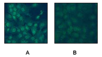 Ab32096, at a 1/250 dilution, staining CREB in A431 cells by Immunofluorescence. Image A: Cells are untreated. Image B: Cells are treated with Phosphatase.
